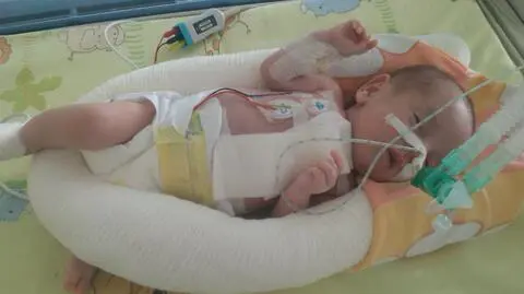 Lekarze wszczepili rozrusznik najmniejszemu wcześniakowi w Polsce