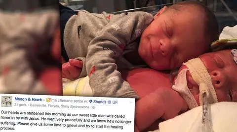 Zdjęcie bliźniaków Buchmeyer poruszyło internautów