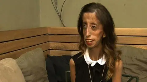 Lizzie Velasquez walczy o dobrę imię