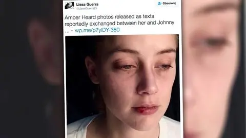 Amber Heard pokazuje kolejne dowody przemocy domowej