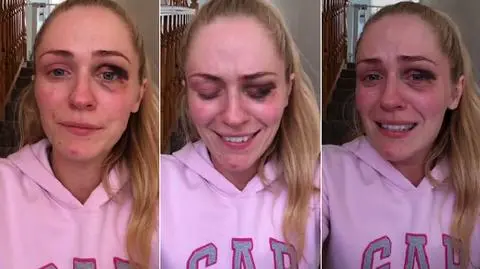 Emma Murphy poruszyła miliony internautów