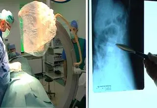 Seniorzy łamią się w ciszy. Trzy czwarte osób nie zna diagnozy