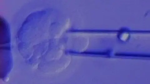 PO zmienia zdanie ws. in vitro