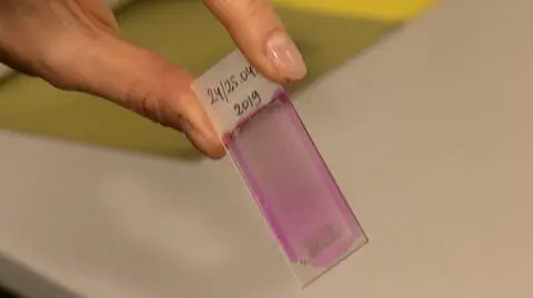 To nie będzie łatwy rok dla alergików