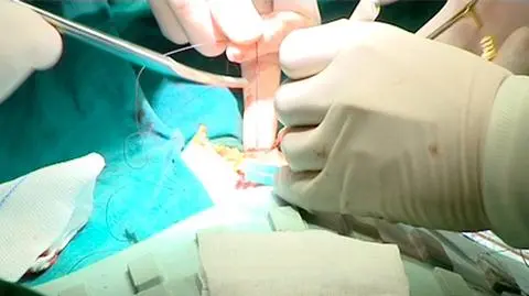 Polskie ręce leczą Afrykę