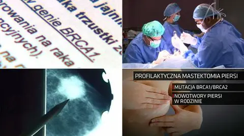 Refundacja profilaktycznej mastektomii ("Polska i Świat" z 10.01.2019)