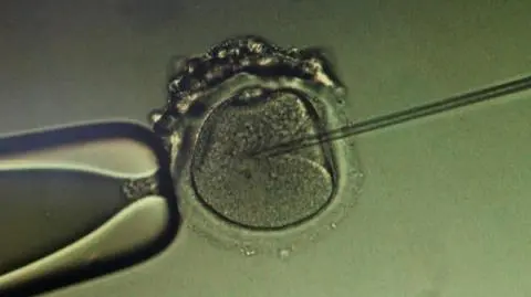 Częstochowa na miejski program leczenia in vitro przeznaczy w tym roku 80 tysięcy złotych 