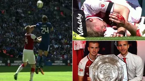 Mertesacker dostał łokciem