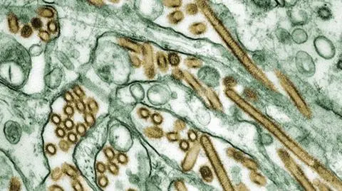 H1N1. Świńska grypa zabija na Ukrainie
