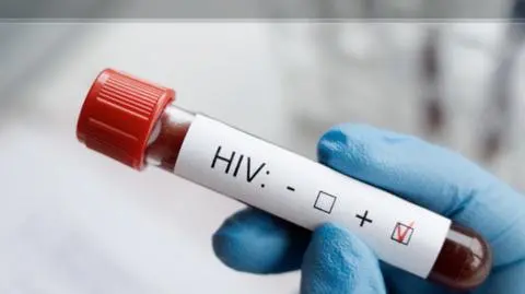 Rośnie liczba zakażonych wirusem HIV w Polsce