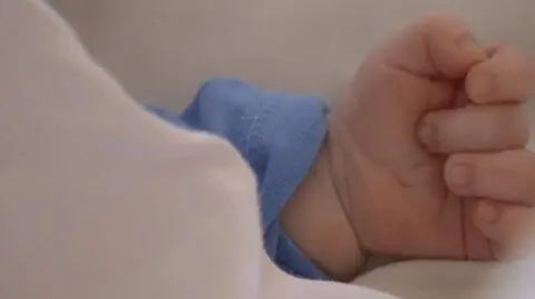 Pęknięta czaszka i podbite oko u dwumiesięcznego dziecka