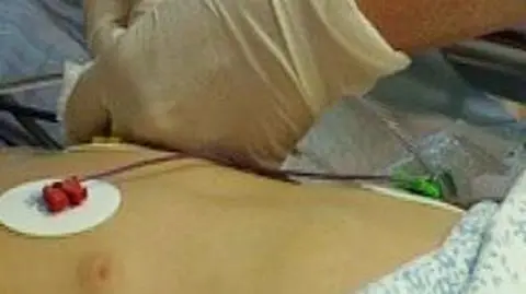 Wciąż szukają dawcy wątroby dla 6-letniego Tomka