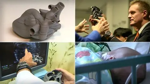 Polscy lekarze stworzyli model serca płodu w 3D