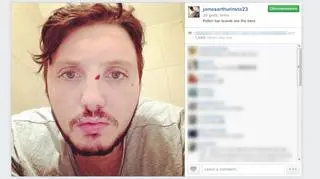 James Arthur brał udział w bójce w jednym z polskich pubów