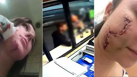 Dziewczyny uderzone w twarz rozbitą butelką szukają napastnika