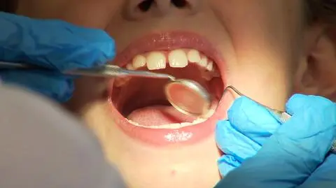 Dzieci z próchnicą często leczą się dopiero w ostateczności