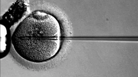 Proces zapłodnienia in vitro składa się z czterech etapów