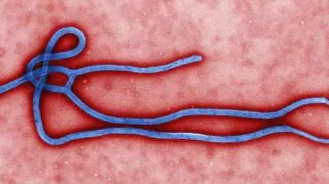 Ebola zabiła 13 osób. Próbują ograniczyć epidemię