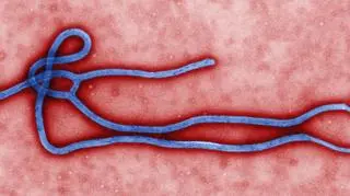 Wirus Ebola pod mikroskopem