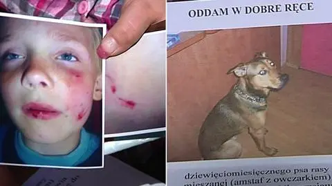 Chłopiec został pogryziony przez psa dwukrotnie