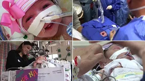 Serce dziewczynki wyrosło poza klatkę piersiową. Operacja się udała