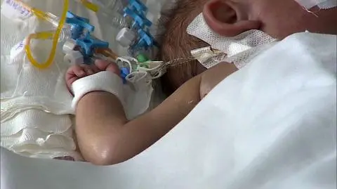 Dwumiesięczna Marysia ma wszczepione dwie komory serca