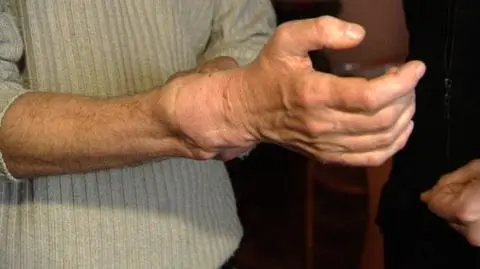 Jest ręka? Jest zdolność do pracy