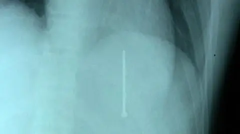 Gwóźdź w sercu