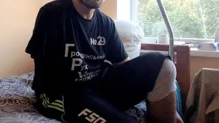 19-letni Wasyl przebywa w szpitalu we Lwowie i czeka na protezę odciętej przez separatystów ręki