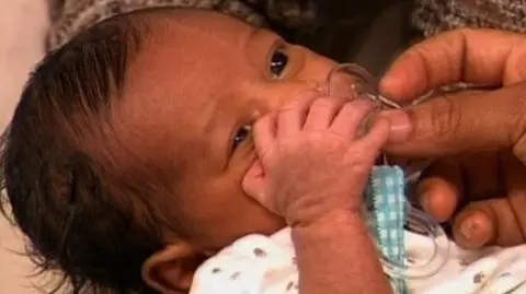 Ma 24 paluszki, wszystkie doskonałe