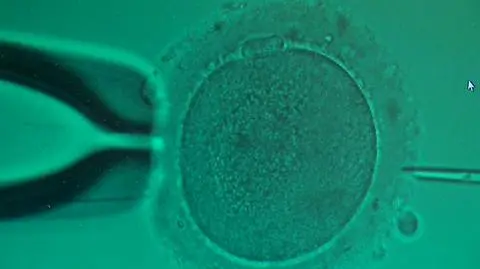 Kontrowersje wokół metody in vitro