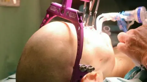 Pionierska operacja. Chłopiec dostał nową twarz