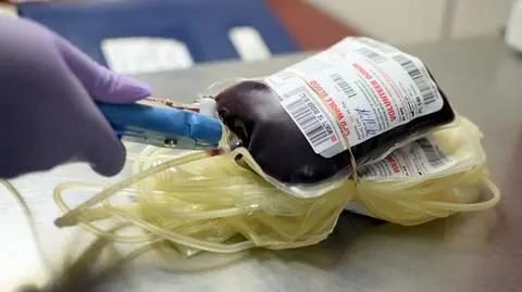Teraz okazało się, że terapia przyniosła pozytywne skutki, a choroba ustępuje