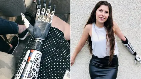 Angel Giuffria i jej "problemy cyborga"