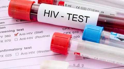 HIV coraz częściej dotyka osoby starsze