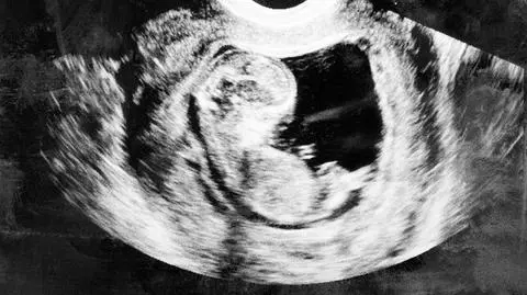 Do marszałka Sejmu trafiły projekty liberalizacji i zaostrzenia prawa aborcyjnego