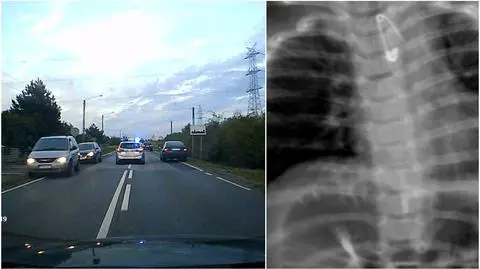 Niemowlę połknęło agrafkę, lekarka odesłała rodziców. Stanęła przed sądem, nie chcą jej ukarania