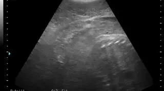 Agata, Ewa, Unda Marina i Ania spodziewają się potomstwa