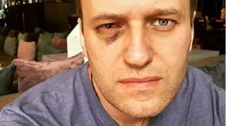 Aleksiej Nawalny po operacji prawego oka 