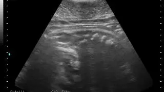 Cztery helskie foki w ciąży