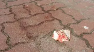 Dziecko trafiło do szpitala w Gdańsku