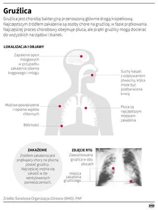 Gruźlica - charakterystyka choroby