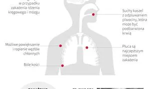 Gruźlica - charakterystyka choroby