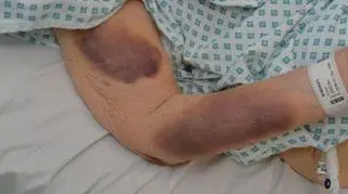 Iris Warner z obrażeniami trafiła do szpitala