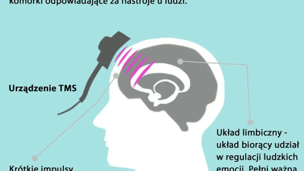 Jak działa NeuroStar?