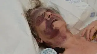 Kobieta ledwo przeżyła pobicie