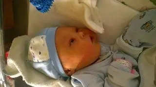Leo urodził się z zespołem Downa