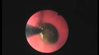 Moneta połknięta przez psa rasy chihuahua