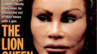 Na drugim miejscu najbogatszych rozwódek świata jest  Jocelyn Wildenstein. Media interesują się nią z powodu operacji plastycznych, dzięki którym upodabnia się do dzikiego kota
