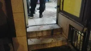 Napastnik został zraniony w rękę